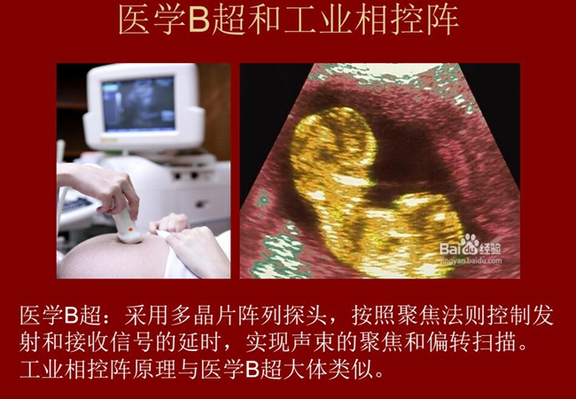 工業(yè)相控陣原理與醫(yī)學(xué)B超大體類(lèi)似，醫(yī)學(xué)B超采用多晶片陣列探頭，按照聚焦法則控制發(fā)射和接收信號(hào)的延時(shí)，實(shí)現(xiàn)聲束的聚焦和偏轉(zhuǎn)掃描